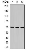 FZD4 / Frizzled 4 Antibody - Western blot analysis of Frizzled 4 expression in HEK293T (A); Raw264.7 (B); PC12 (C) whole cell lysates.