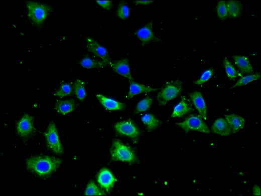 FZD4 / Frizzled 4 Antibody - Immunofluorescent analysis of PC3 cells using FZD4 Antibody at a dilution of 1:100 and Alexa Fluor 488-congugated AffiniPure Goat Anti-Rabbit IgG(H+L)