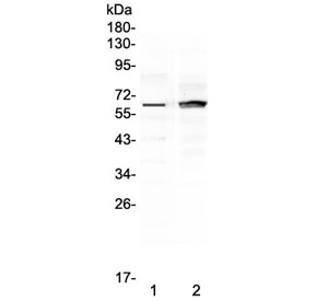 FZD4 / Frizzled 4 Antibody - Western blot testing of human 1) placenta and 2) MCF7 lysate with FZD4 antibody at 0.5ug/ml. Predicted molecular weight ~60 kDa.