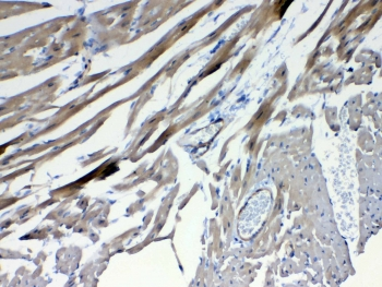 FZD4 / Frizzled 4 Antibody - IHC testing of FFPE mouse heart tissue with FZD4 antibody at 1ug/ml. Required HIER: steam section in pH6 citrate buffer for 20 min and allow to cool prior to testing.