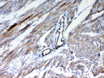 FZD4 / Frizzled 4 Antibody - IHC testing of FFPE rat heart tissue with FZD4 antibody at 1ug/ml. Required HIER: steam section in pH6 citrate buffer for 20 min and allow to cool prior to testing.