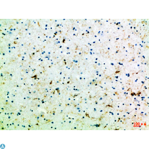 FZD4 / Frizzled 4 Antibody - Immunohistochemical analysis of paraffin-embedded Human-brain, antibody was diluted at 1:100.