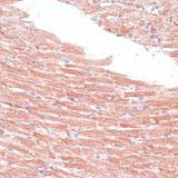 FZD4 / Frizzled 4 Antibody - Immunohistochemistry of paraffin-embedded Mouse heart using FZD4 Polyclonal Antibody at dilution of 1:100 (40x lens).