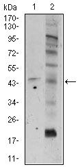 FZD5 / Frizzled 5 Antibody - FZD5 Antibody in Western Blot (WB)