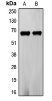 FZD5 / Frizzled 5 Antibody - Western blot analysis of Frizzled 5 expression in PC3 (A); LOVO (B) whole cell lysates.