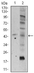 FZD5 / Frizzled 5 Antibody - Western blot using FZD5 mouse monoclonal antibody against A549 (1), and PC-3 (2) cell lysate.