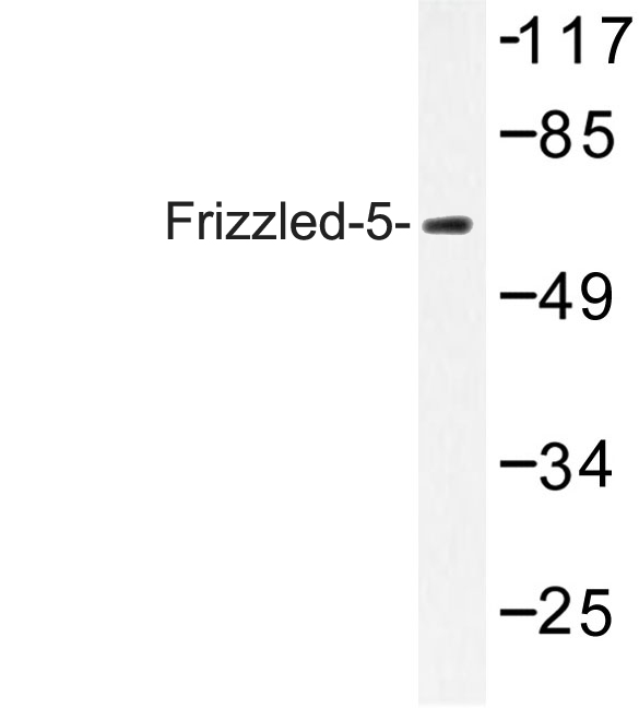FZD5 / Frizzled 5 Antibody - Western blot of Frizzled-5 (Y500) pAb in extracts from LOVO cells.