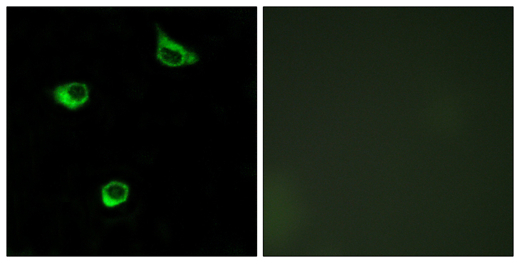 FZD6 / Frizzled 6 Antibody - Immunofluorescence analysis of COS7 cells, using FZD6 Antibody. The picture on the right is blocked with the synthesized peptide.