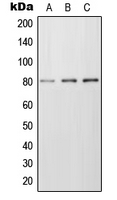 FZD6 / Frizzled 6 Antibody - Western blot analysis of Frizzled 6 expression in MCF7 (A); Raw264.7 (B); PC12 (C) whole cell lysates.