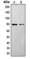 FZD6 / Frizzled 6 Antibody - Western blot analysis of Frizzled 6 expression in HT29 (A); HeLa (B) whole cell lysates.
