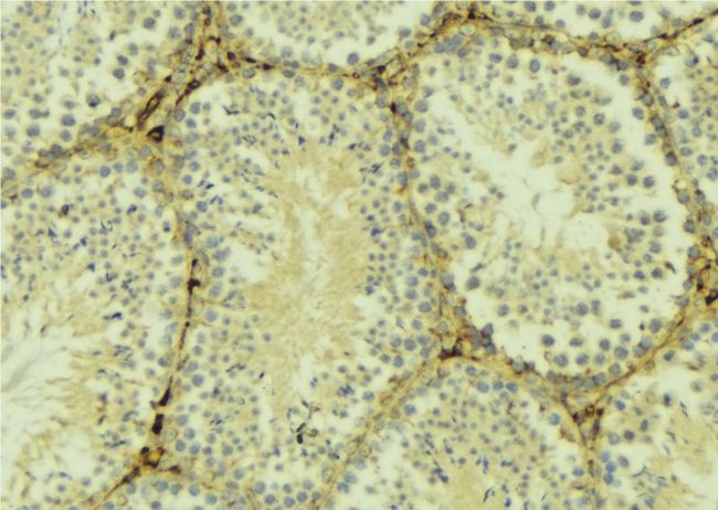 FZD6 / Frizzled 6 Antibody - 1:100 staining mouse testis tissue by IHC-P. The sample was formaldehyde fixed and a heat mediated antigen retrieval step in citrate buffer was performed. The sample was then blocked and incubated with the antibody for 1.5 hours at 22°C. An HRP conjugated goat anti-rabbit antibody was used as the secondary.