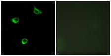 FZD6 / Frizzled 6 Antibody - Peptide - + Immunofluorescence analysis of COS-7 cells, using FZD6 antibody.