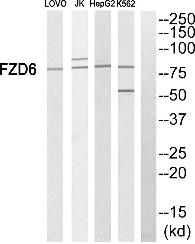 FZD6 / Frizzled 6 Antibody - Western blot analysis of extracts from LOVO cells, Jurkat cells, HepG2 cells and K562 cells, using FZD6 antibody.