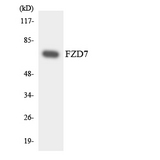 FZD7 / Frizzled 7 Antibody - Western blot analysis of the lysates from HUVECcells using FZD7 antibody.