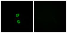 FZD7 / Frizzled 7 Antibody - Immunofluorescence analysis of MCF7 cells, using FZD7 Antibody. The picture on the right is blocked with the synthesized peptide.