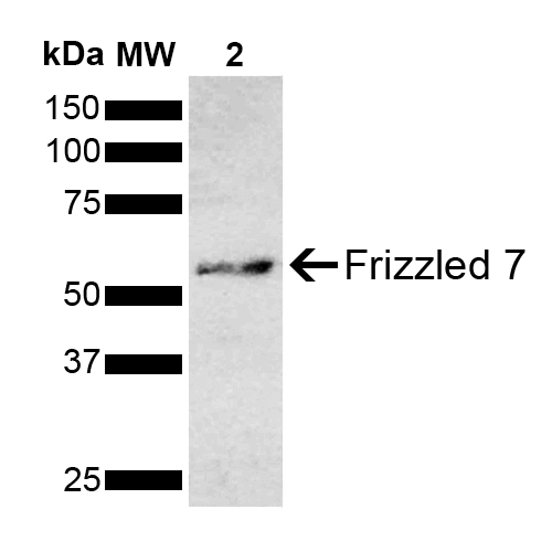 FZD7 / Frizzled 7 Antibody - Western blot analysis of Mouse Brain showing detection of ~63 kDa Frizzled 7 protein using Rabbit Anti-Frizzled 7 Polyclonal Antibody. Lane 1: Molecular Weight Ladder (MW). Lane 2: Mouse Brain. Load: 15 µg. Block: 5% Skim Milk in 1X TBST. Primary Antibody: Rabbit Anti-Frizzled 7 Polyclonal Antibody  at 1:1000 for 2 hours at RT. Secondary Antibody: Goat Anti-Rabbit IgG: HRP at 1:4000 for 1 hour at RT. Color Development: ECL solution for 5 min at RT. Predicted/Observed Size: ~63 kDa.
