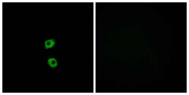 FZD7 / Frizzled 7 Antibody - Peptide - + Immunofluorescence analysis of MCF-7 cells, using FZD7 antibody.