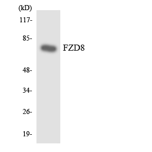 FZD8 / Frizzled 8 Antibody - Western blot analysis of the lysates from HUVECcells using FZD8 antibody.