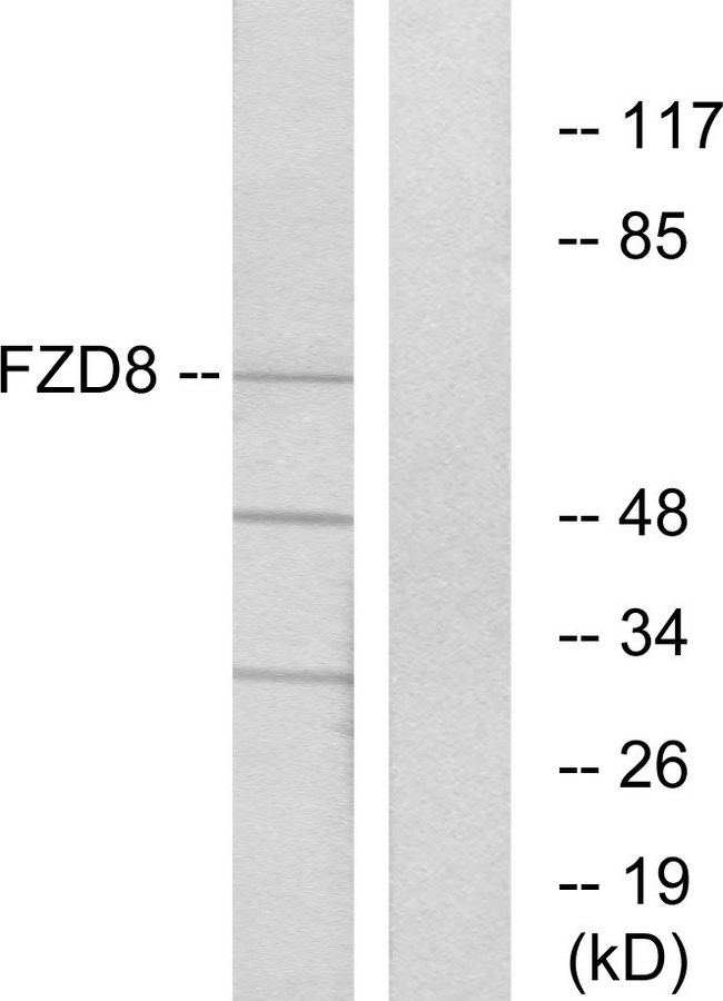 FZD8 / Frizzled 8 Antibody - Western blot analysis of lysates from Jurkat cells, using FZD8 Antibody. The lane on the right is blocked with the synthesized peptide.