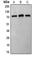 FZD8 / Frizzled 8 Antibody - Western blot analysis of Frizzled 8 expression in HeLa (A); Jurkat (B); MCF7 (C) whole cell lysates.