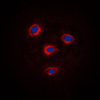 FZD8 / Frizzled 8 Antibody - Immunofluorescent analysis of Frizzled 8 staining in Jurkat cells. Formalin-fixed cells were permeabilized with 0.1% Triton X-100 in TBS for 5-10 minutes and blocked with 3% BSA-PBS for 30 minutes at room temperature. Cells were probed with the primary antibody in 3% BSA-PBS and incubated overnight at 4 C in a humidified chamber. Cells were washed with PBST and incubated with a DyLight 594-conjugated secondary antibody (red) in PBS at room temperature in the dark. DAPI was used to stain the cell nuclei (blue).