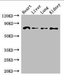FZD8 / Frizzled 8 Antibody - Positive WB detected in:Mouse heart tissue,Mouse liver tissue,Mouse lung tissue,Mouse kidney tissue;All lanes: FZD8 antibody at 2.7ug/ml;Secondary;Goat polyclonal to rabbit IgG at 1/50000 dilution;Predicted band size: 74 kDa;Observed band size: 74 kDa;