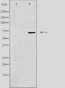 FZD8 / Frizzled 8 Antibody - Western blot analysis of extracts of Jurkat cells using FZD8 antibody. The lane on the left is treated with the antigen-specific peptide.