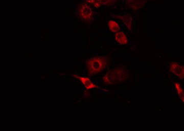FZD8 / Frizzled 8 Antibody - Staining HeLa cells by IF/ICC. The samples were fixed with PFA and permeabilized in 0.1% Triton X-100, then blocked in 10% serum for 45 min at 25°C. The primary antibody was diluted at 1:200 and incubated with the sample for 1 hour at 37°C. An Alexa Fluor 594 conjugated goat anti-rabbit IgG (H+L) Ab, diluted at 1/600, was used as the secondary antibody.