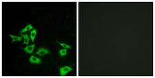 FZD8 / Frizzled 8 Antibody - Peptide - + Immunofluorescence analysis of A549 cells, using FZD8 antibody.