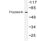 FZD8 / Frizzled 8 Antibody - Western blot of Frizzled-8 (K528) pAb in extracts from Jurkat cells.