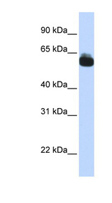 FZD9 / Frizzled 9 Antibody - FZD9 / Frizzled 9 antibody Western blot of Fetal Brain lysate. This image was taken for the unconjugated form of this product. Other forms have not been tested.