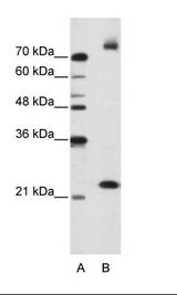 FZD9 / Frizzled 9 Antibody - B: Jurkat Cell Lysate.  This image was taken for the unconjugated form of this product. Other forms have not been tested.