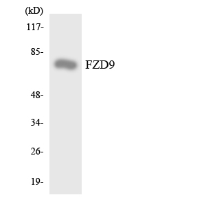 FZD9 / Frizzled 9 Antibody - Western blot analysis of the lysates from HeLa cells using FZD9 antibody.