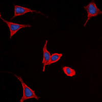FZD9 / Frizzled 9 Antibody - Immunofluorescent analysis of Frizzled 9 staining in Y79 cells. Formalin-fixed cells were permeabilized with 0.1% Triton X-100 in TBS for 5-10 minutes and blocked with 3% BSA-PBS for 30 minutes at room temperature. Cells were probed with the primary antibody in 3% BSA-PBS and incubated overnight at 4 ??C in a humidified chamber. Cells were washed with PBST and incubated with a DyLight 594-conjugated secondary antibody (red) in PBS at room temperature in the dark. DAPI was used to stain the cell nuclei (blue).