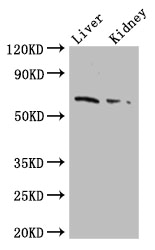 FZD9 / Frizzled 9 Antibody - Positive WB detected in:Mouse liver tissue,Mouse kidney tissue;All lanes: FZD9 antibody at 2.5ug/ml;Secondary;Goat polyclonal to rabbit IgG at 1/50000 dilution;Predicted band size: 65 kDa;Observed band size: 65 kDa;