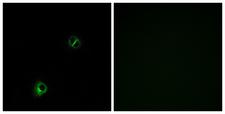 FZD9 / Frizzled 9 Antibody - Peptide - + Immunofluorescence analysis of A549 cells, using FZD9 antibody.