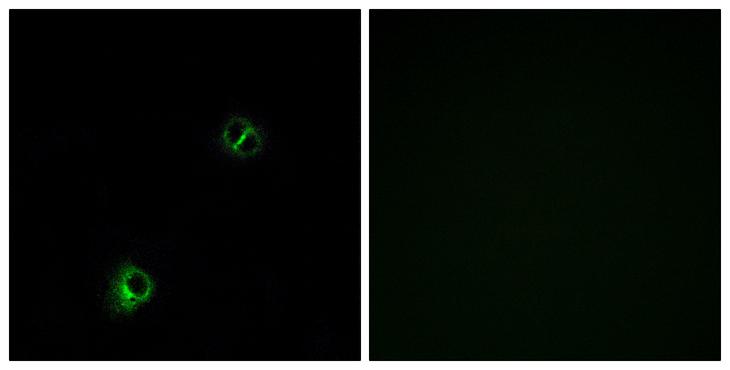 FZD9 / Frizzled 9 Antibody - Peptide - + Immunofluorescence analysis of A549 cells, using FZD9 antibody.