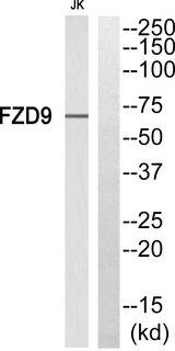 FZD9 / Frizzled 9 Antibody - Western blot analysis of extracts from Jurkat cells, using FZD9 antibody.