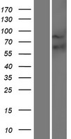 FZD9 / Frizzled 9 Protein - Western validation with an anti-DDK antibody * L: Control HEK293 lysate R: Over-expression lysate
