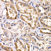 FZR1 Antibody - Immunohistochemistry of paraffin-embedded human kidney cancer tissue.