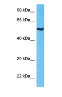 FZR1 Antibody - Western blot of FZR Antibody with human Ovary Tumor lysate.  This image was taken for the unconjugated form of this product. Other forms have not been tested.