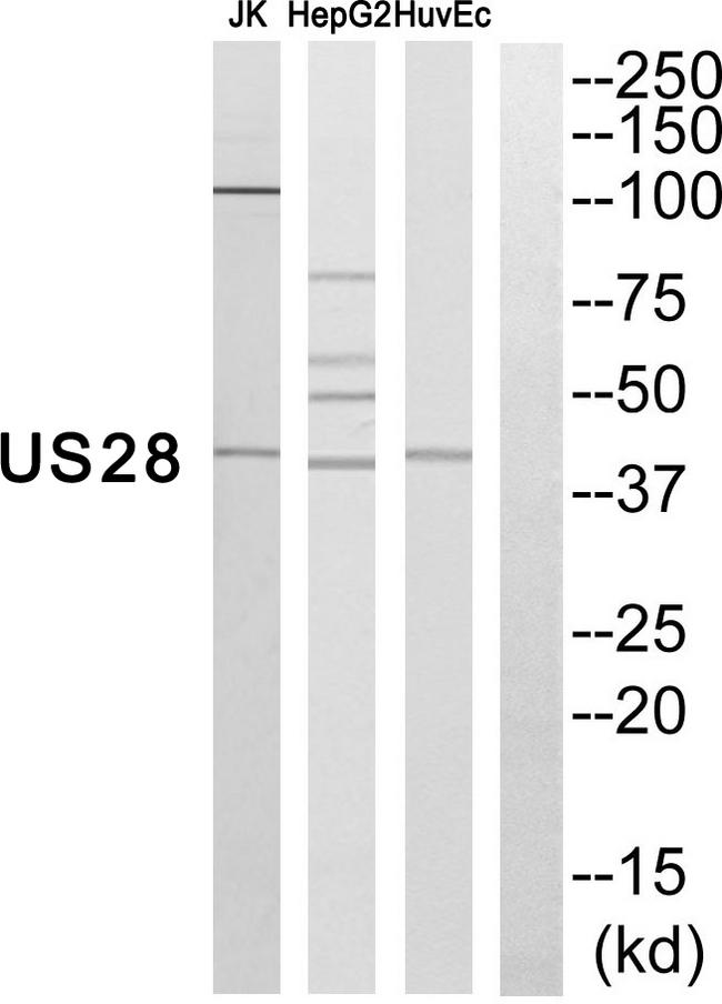 G Protein-coupled Receptor US28 (HHRF3) [Cytomegalovirus] Antibody - Western blot analysis of extracts from JK cells, HepG2 cells and HuvEc cells, using US28 antibody.