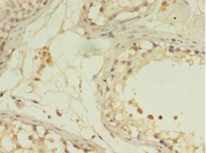 G0S2 Antibody - Immunohistochemistry of paraffin-embedded human testis using antibody at 1:100 dilution.  This image was taken for the unconjugated form of this product. Other forms have not been tested.