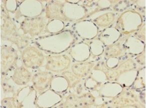 G0S2 Antibody - Immunohistochemistry of paraffin-embedded human kidney using antibody at 1: 100 dilution.  This image was taken for the unconjugated form of this product. Other forms have not been tested.