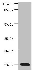 G0S2 Antibody - Western blot All lanes: G0S2 antibody at 2µg/ml + Mouse heart tissue Secondary Goat polyclonal to rabbit IgG at 1/10000 dilution Predicted band size: 11 kDa Observed band size: 20 kDa