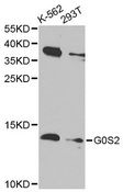 G0S2 Antibody - Western blot analysis of extracts of various cell lines, using G0S2 antibody at 1:1000 dilution. The secondary antibody used was an HRP Goat Anti-Rabbit IgG (H+L) at 1:10000 dilution. Lysates were loaded 25ug per lane and 3% nonfat dry milk in TBST was used for blocking. An ECL Kit was used for detection and the exposure time was 90s.