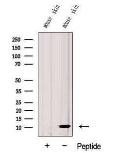 G0S2 Antibody - Western blot analysis of extracts of mouse skin tissue using G0S2 antibody. The lane on the left was treated with blocking peptide.