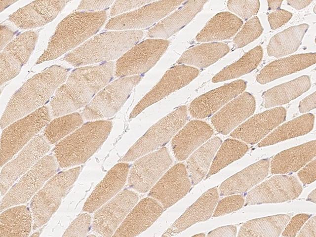 G0S2 Antibody - Immunochemical staining of human G0S2 in human skeletal muscle with rabbit polyclonal antibody at 1:100 dilution, formalin-fixed paraffin embedded sections.