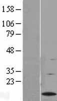 G0S2 Protein - Western validation with an anti-DDK antibody * L: Control HEK293 lysate R: Over-expression lysate