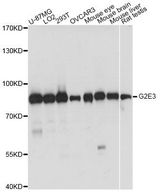 G2E3 / KIAA1333 Antibody - Western blot analysis of extracts of various cell lines, using G2E3 antibody at 1:1000 dilution. The secondary antibody used was an HRP Goat Anti-Rabbit IgG (H+L) at 1:10000 dilution. Lysates were loaded 25ug per lane and 3% nonfat dry milk in TBST was used for blocking. An ECL Kit was used for detection and the exposure time was 1s.